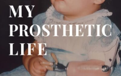 Excerpt from Chapter 1 – My Prosthetic Life